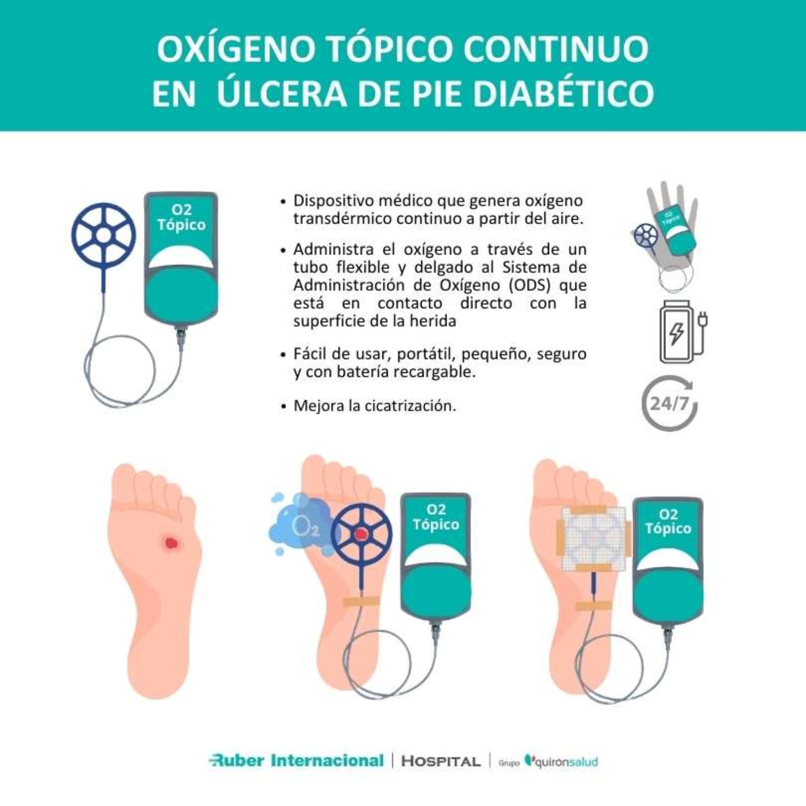 tratamiento-de-la-lcera-del-pie-diab-tico